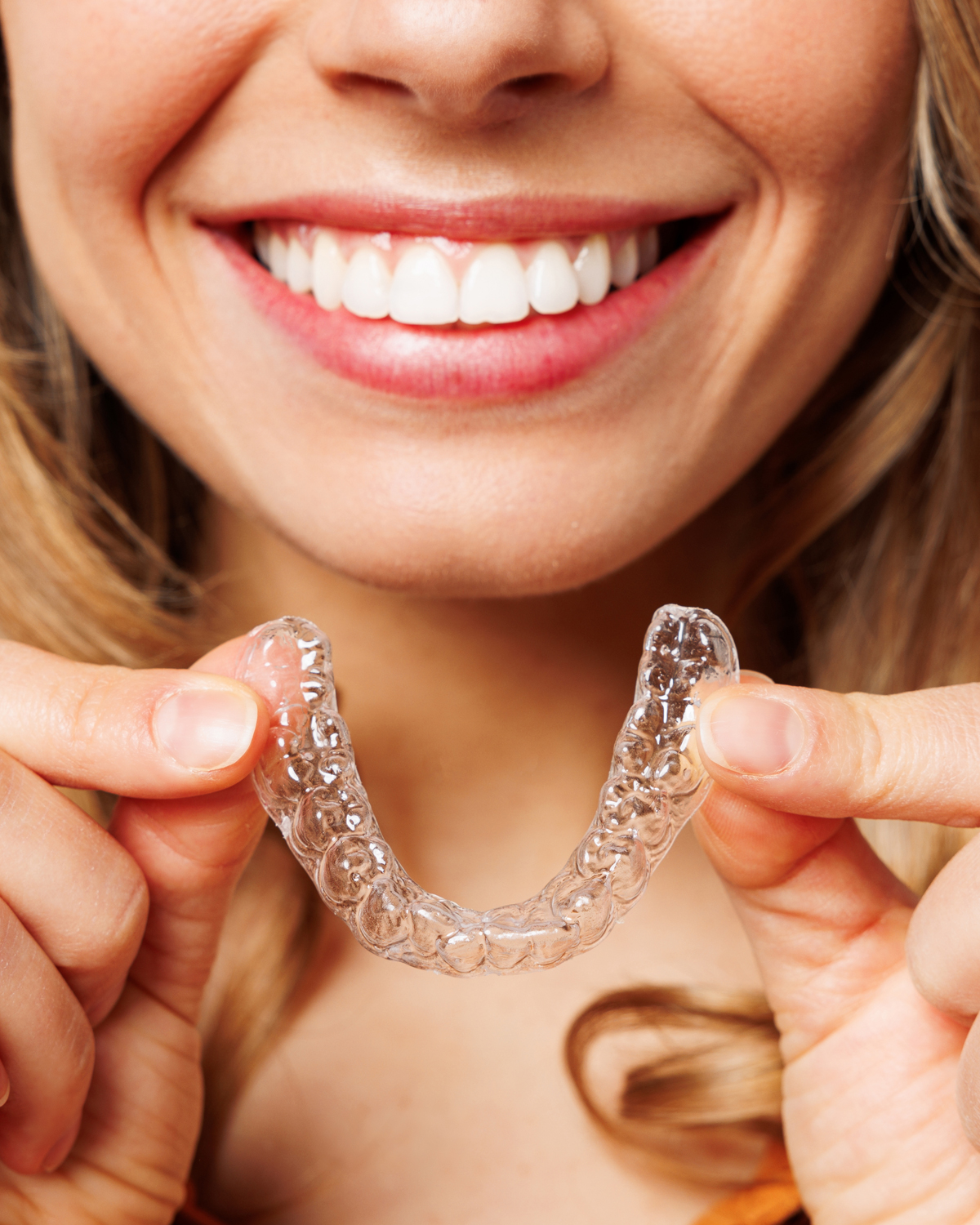 Clear dental aligners - modern orthodontic solution
